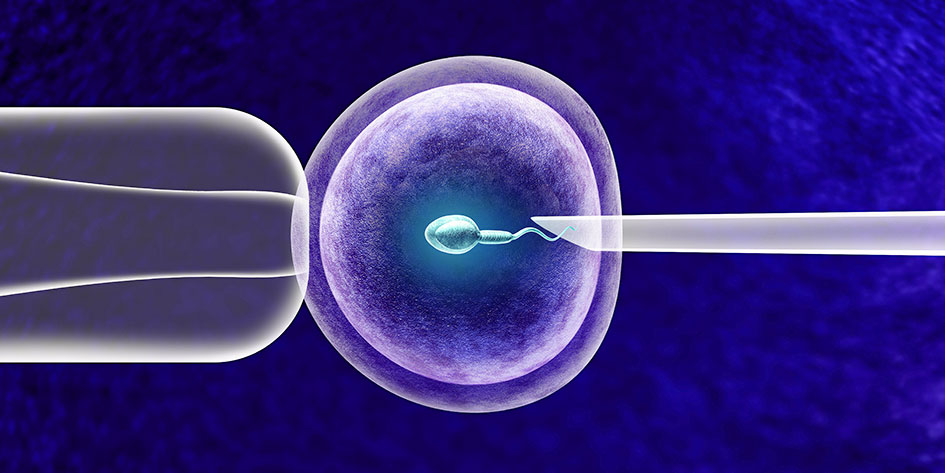 IVF im natürlichen Zyklus – bei der richtigen Indikation ein großer Fortschritt für Kinderwunschpaare
